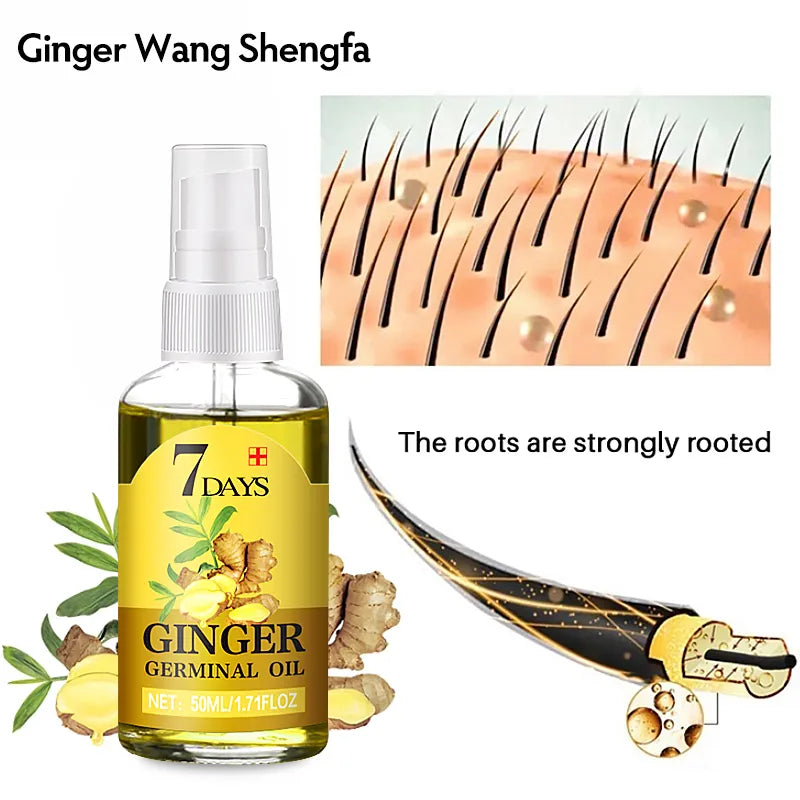 Fast Hair Growth Men Women Ginger Growth Hair Oil Treatment Anti Hair Loss Scalp Treatment Serum Products Beauty Health