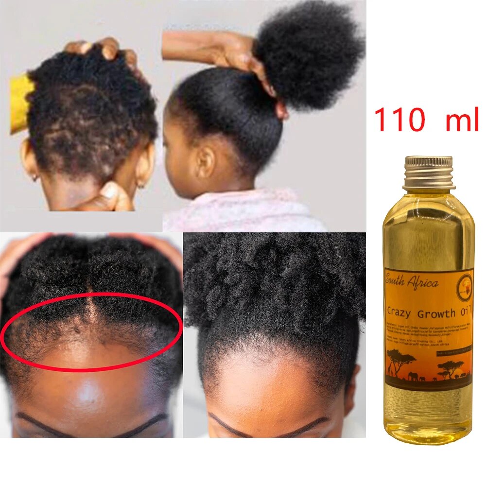 GROW YOUR HAIR FASTER LONGER IN ONE MONTH Chebe Powder Extraction Oil  Soften and Smooth Stop Breakage for Hair Growth