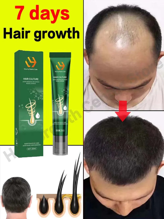 Hair Growth Oil Fast Hair Growth Effective Baldness Repair Hereditary Hair Loss Postpartum Hair Loss Seborrheic Hair Loss