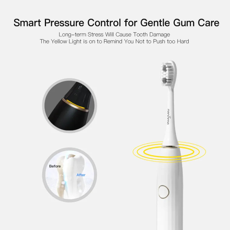 Nandme NX8000 Smart Sonic Electric Toothbrush IPX7 Waterproof Micro Vibration Deep Cleaning Whitener Without Hurting Teeth