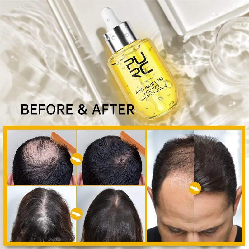 PURC Fast Hair Growth for Men Women Ginger Grow Hair Oil Care Anti Hair Loss Scalp Treatment Serum Products Beauty Health 2023