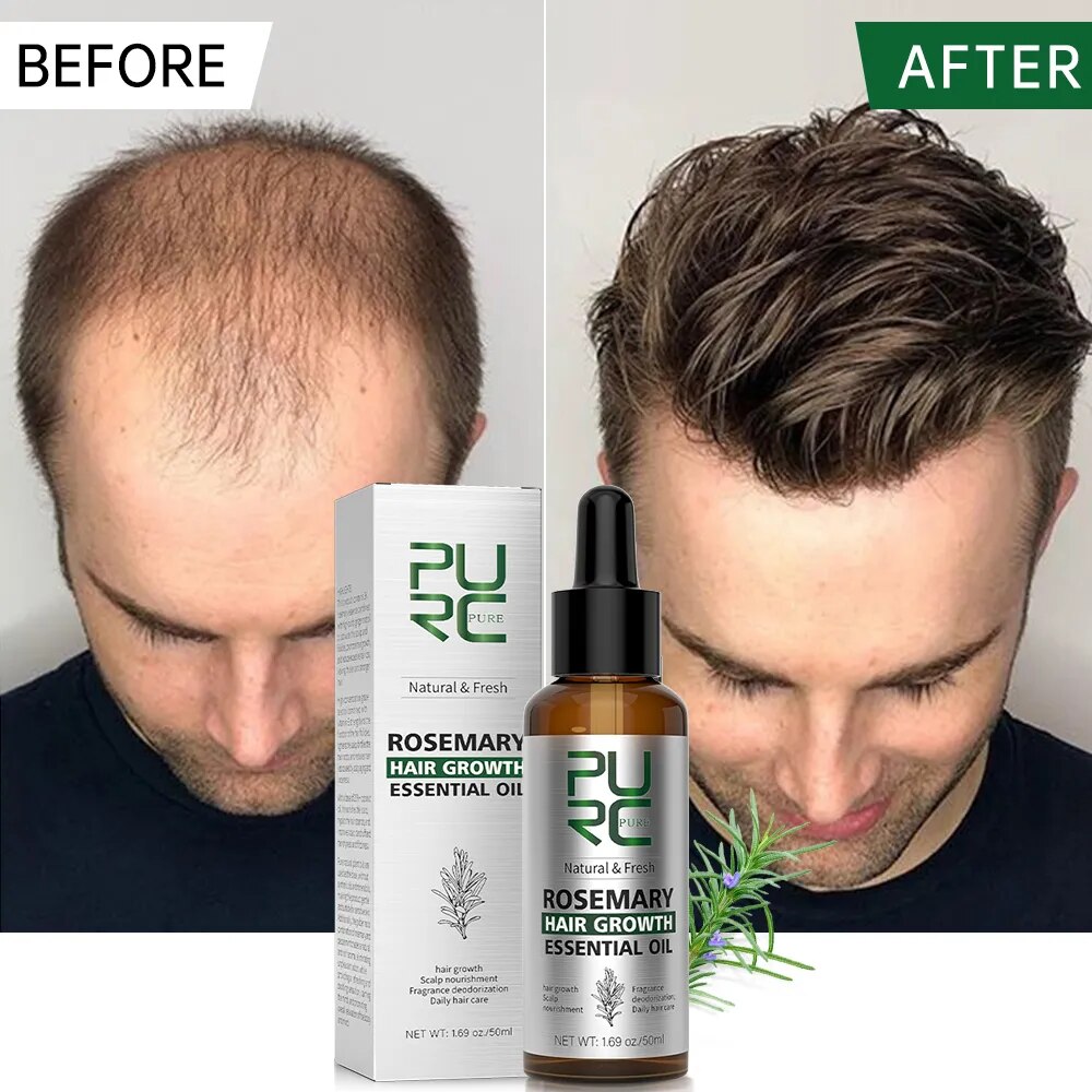 PURC Rosemary Oil Hair Growth Products for Man Women Ginger Anti Hair Loss Fast Regrowth Thicken Oils Scalp Treatment Hair Care